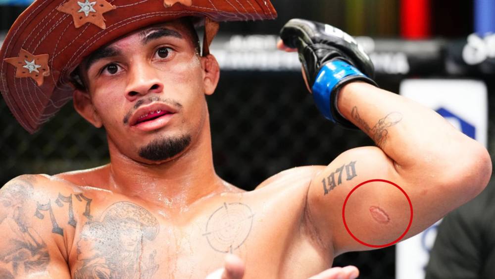 Mitch Raposo vs Andre Lima Prediction UFC 302 Picks 6/1