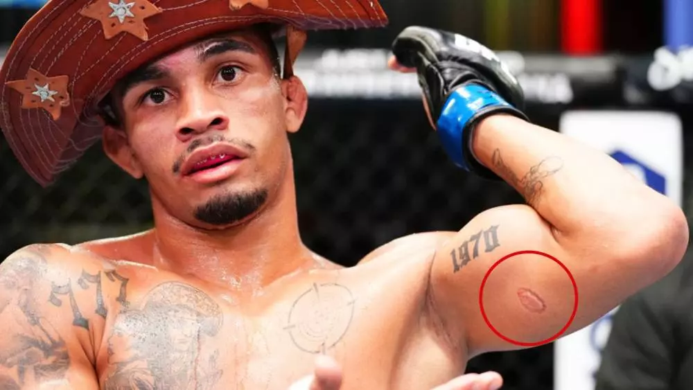Mitch Raposo vs Andre Lima Prediction UFC 302 Picks 6/1